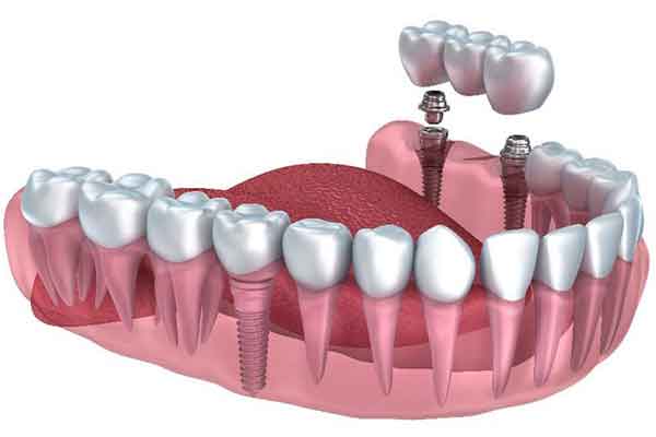 Prosthodontics Department